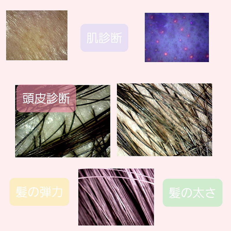頭皮診断